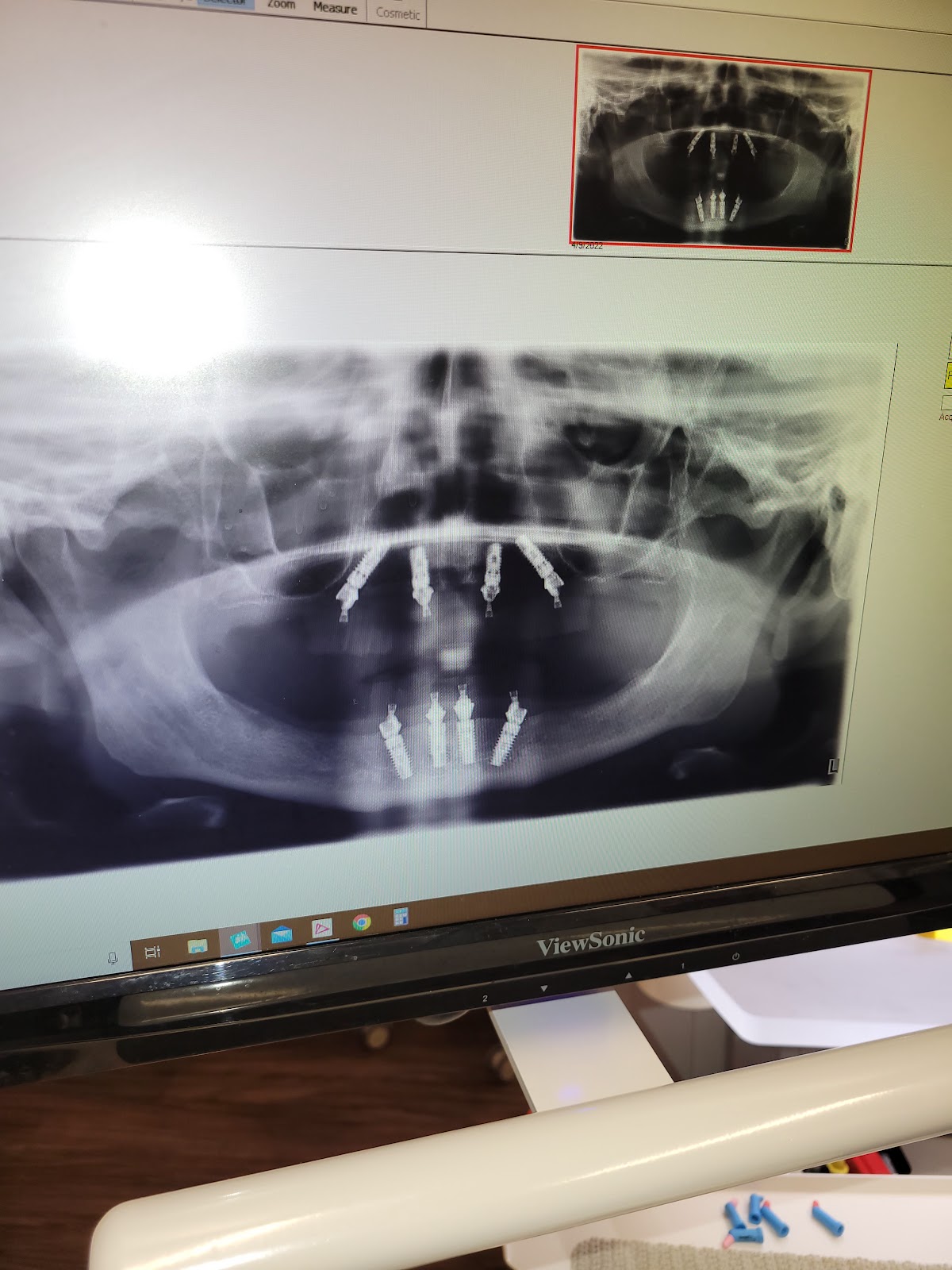 360 Family and Implant Dentistry- Dr. Ticole Nguyen and Dr. Christopher Gonzales - dentists in Grand Prairie, TX (Photo 1)